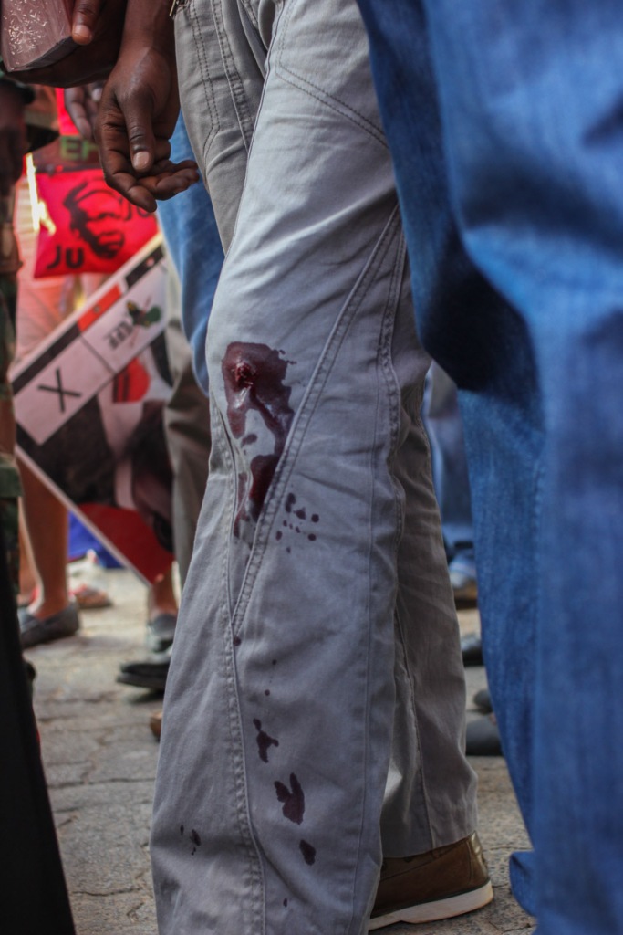 SOUTH AFRICA: An EFF member was shot and wounded at the party rally outside the Madala Hostel in Alexandra township, a walking distance from where the leader of EFF Julius Malema was due to speak. The match was a campaign against the ongoing attacks on foreign nationals. 20 April 2015. © JABULILE PEARL HLANZE